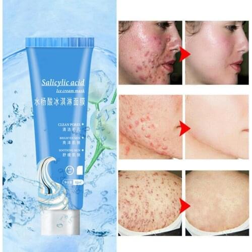 HOT SALES!!! Salicylic Acid Acne Scars Blackhead Removal Hydrating Moisture Skin Face Cream