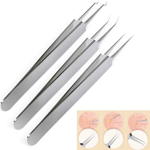3Pcs Set Stainless Steel Blackhead Remover Tweezers Professional Pimple Blemish Extractor Set Nail Art/Face Care/Eyelash Removal