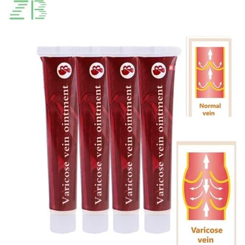 20G 100% Original Medicine PlasterTreatment Spider Veins Varicose Ointment Leg MassageVaricose Veins unguent Pain Relief Cream