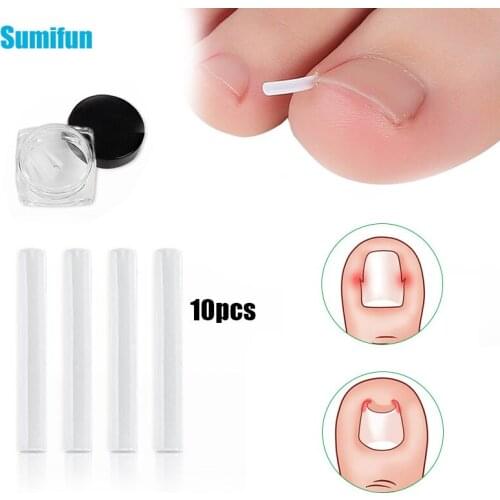10pcs/box Ingrown Toenail Correction Tool Invisible Ingrown Toe Nail Padding Elastic Straightening Clip Brace Pedicure Tool