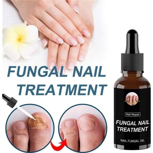 Fast Fungal Nail Treatments Serum Onychomycosis Paronychia Anti-Fungal Nail Sensitive Herb Toe Fungus Foot Repair Essences Care
