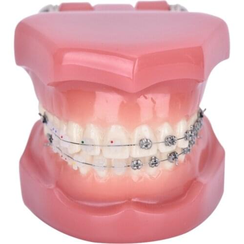 Teeth Model Implant Disease Teeth Model Dentist Studying Model