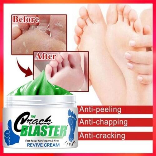 Effective Hand Foot Care Cream Pedicure Repair Heel Crack Chaps Peeling Anti Dry Frostbite Finger Skin Revive Nourishing Cream