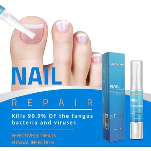 Powerful Nail Treatment Pen Onychomycosis Paronychia Anti Fungal Nail Infection Chinese Herbal Toe Fungus Care Repair Serum