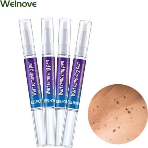 Skin Tag Remover Chinese Medicine Body Warts Treatment Foot Corn Removal Skin Tags Removing Remover Care Anti Verruca Remedy