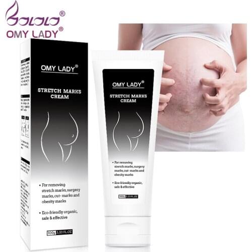 OMY LADY Cream For Stretch Marks