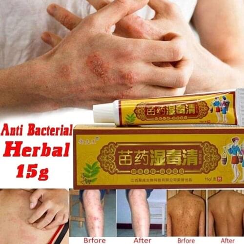 1 Piece Health Care Skin Fungus Anti Bacterial Cream Natural Chinese Herbs Cream Onitment for Psoriasis Dermatitis Eczema Treatm