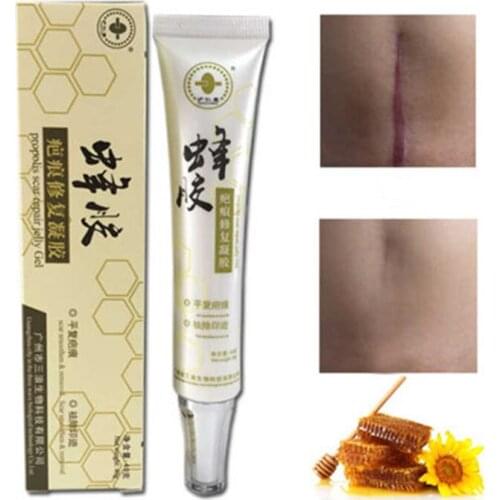 Acne Scar Repair Cream Scar Remove Cream 40g