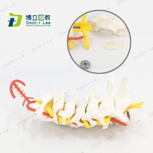 Ntervertebral Disc Nerve Carotid Carotid Joint Neck Bone Blood Vessel Detachable Cervical Spine Anatomy Model