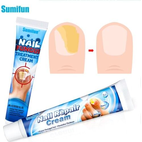 2types Nail Fungus Removal Cream Onychomycosis Fungal Nail Treatment Oil Paronychia Anti Infection Feet Toe Fungal Nail Ointment