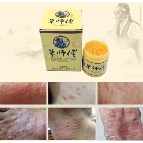 1pc Psoriasis Eczma Cream Works Perfect For All Kinds Of Skin Problems Patch Body Massage Ointment Chinese herbal Medicine