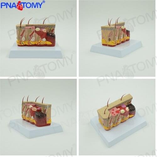 Anatomy Model of Human Skin Tissue Hierarchy Teaching Cosmetic Management Micro Plastic Surgery Dermatology
