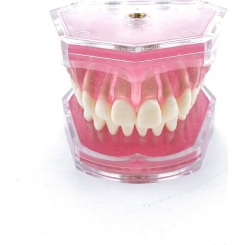 Dental Standard Model with Removable Teeth Dental Study Teach Teeth Model #7008