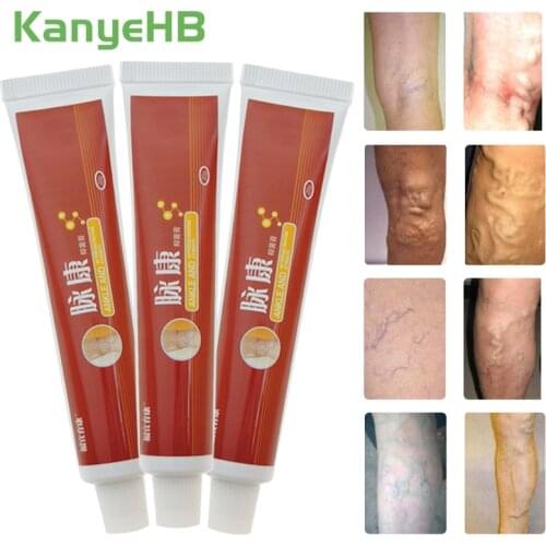 3pcs Varicose Veins Ointment Vasculitis Treatment Vessel Blood Legs Inflammation Ointment Angiitis Phlebitis Spider Cream A429