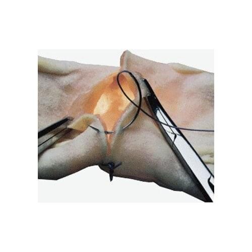 The intestinal tubes match the model