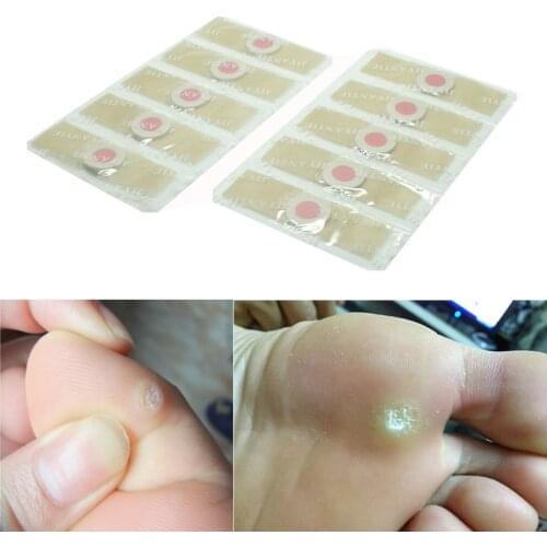 36pcs Medical plaster Foot Corn Removal Remover Warts Thorn Plaster Of Calluses Patch Callosity Detox Foot Pad Curative Plasters