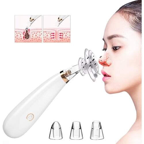 Electric Vacuum Black Head Remover 3 Suction Heads Remove Black Head Clean Pores Tight Skin lower Noise Powered by 2 AA Battery