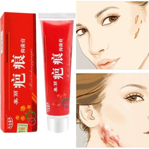 Snake Oil For 95% Acne Scar Removal Cream Pimples Stretch Marks Face Gel Remove Acne Smoothing Whitening Moisturizing Skin Care