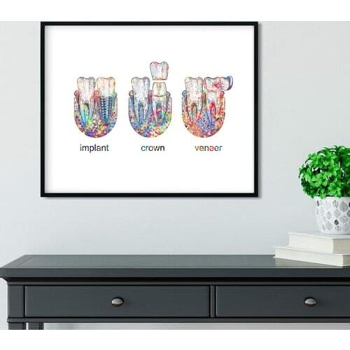 Tooth Implant Art Dental Crown Print Dentist Gift Tooth Anatomy Medical Wall Art Canvas Painting Picture Dental Clinic Decor