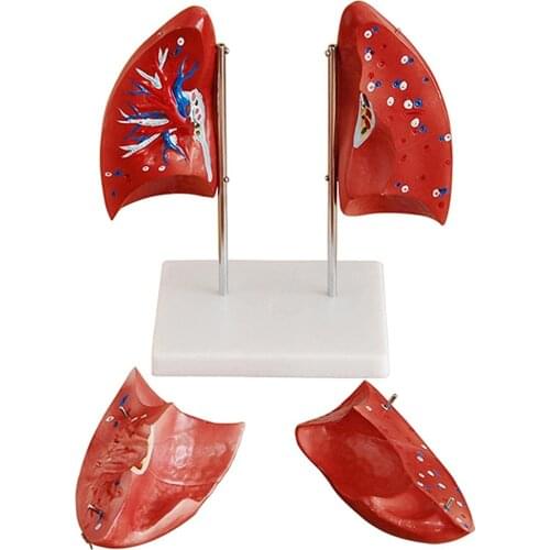 Human Lung Anatomical Model Human Organ Lung Demonstration Model Removable 4 Part Organ Lung Anatomical Model