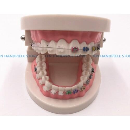 2018 Orthodontics Model for Dentist Dental 1/2 Standard Dentition with half Metal Brackets half ceramic bracket Teeth Model