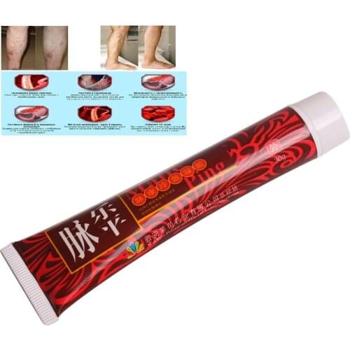 1 Varicose Veins Treatment Cream Ointment Vasculitis Phlebitis Spider Veins Pain Varicosity Angiitis Remedy Removal Herbal Cream