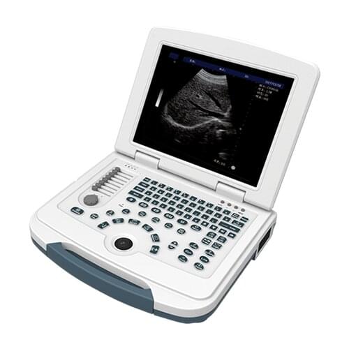 Cheapest price Laptop Digital 15 inch 2D 3D 4D obstetric gynecology ultrasound medical scanner medical ultrasound instruments