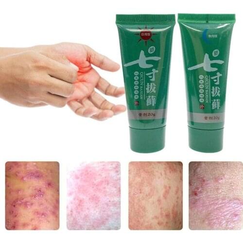 100% Original Body Psoriasis Cream Dermatitis Eczematoid Treatment Cream Natural Eczema Cream 2 Care Psoriasis Herb Skin pc I2B5