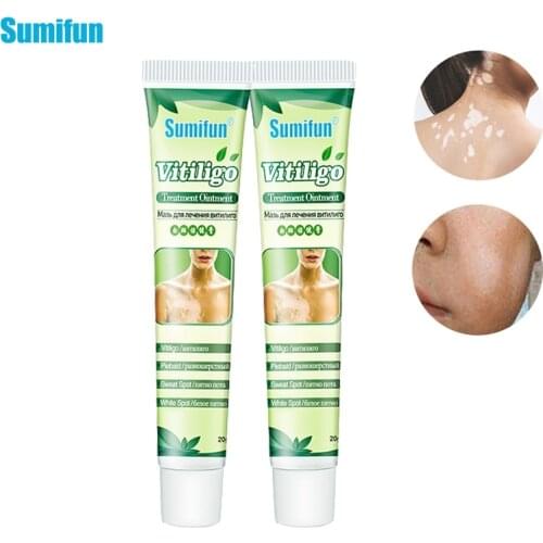 1/2pcs Chinese Vitiligo Ointment Medical Pigment Melanin Skin Care Balm White Spot Localized Vitiligo Mycosis Leukoplakia P1202