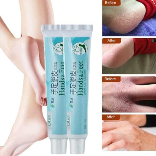 Увлажняющие маски для ног ROSOTENA China At AliExpress