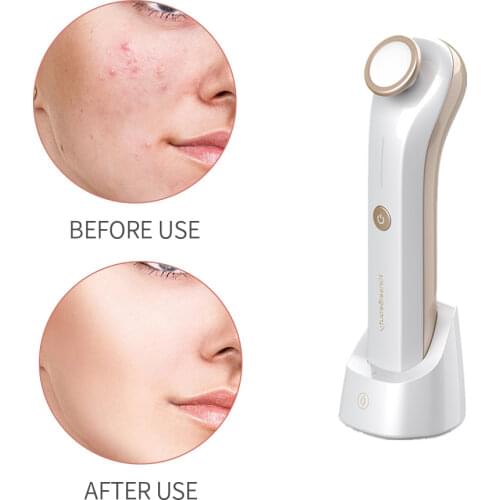 Face Acne Cleansing Treatment Pen Blue Light Plasma Ultrasound Facial Clean Machine Pimple Scar Removal Machine Beauty Device