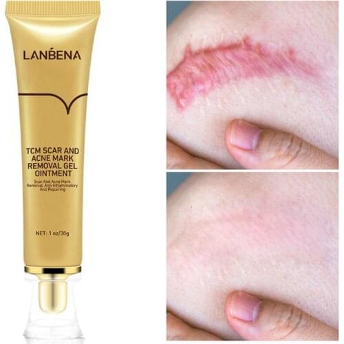 30g Scar Cream And Acne Mark Removal Ointment Gel - For Wounds Cuts And Burn Repair Skin Care Cream