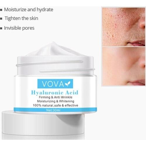 Effective Whitening Cream Freckle Remove Melasma Acne Spot Pigment Melanin Dark Spots Pigmentation Moisturizing Gel Skin Care