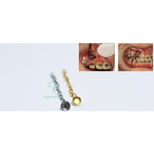 Sale 4Pcs Dental Group Orthodontic Button Chain Silver Lingual Traction Chain