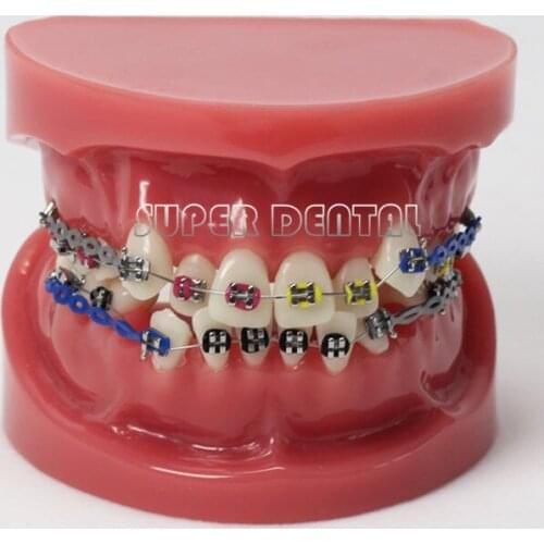 Teeth Orthodontic Model Bracket arch wire with wax dental model tooth model with metal brace