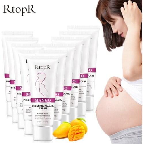 Mango Pregnancy Cream Removes Scars Reduces Wrinkles Protects Pregnant Women Skin Deeply Repairs Skin Increases Skin Vitality