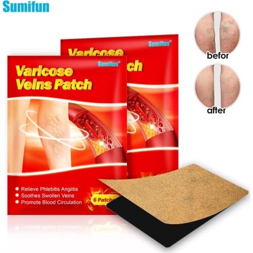 18pcs Varicose Veins Herbal Medical Plaster Vasculitis Phlebitis Spider Leg Treatment Patch Angiitis Removal Plastry Skin Care