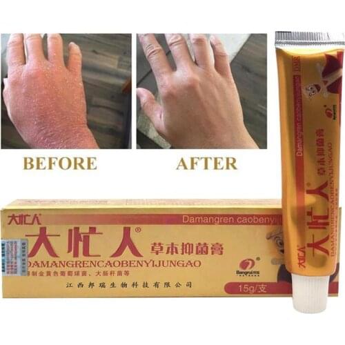 1 pcs Damangren Original Psoriasis Dermatitis Eczema Health Skin Care Massage Problems Tool Pruritus Skin Cream Cream Care D3N1