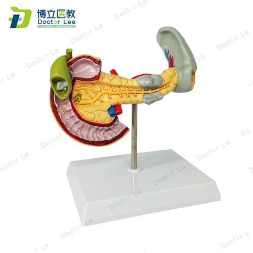 Anatomical Pathological digestive system model of pancreas with spleen and duodenum for teaching demonstration