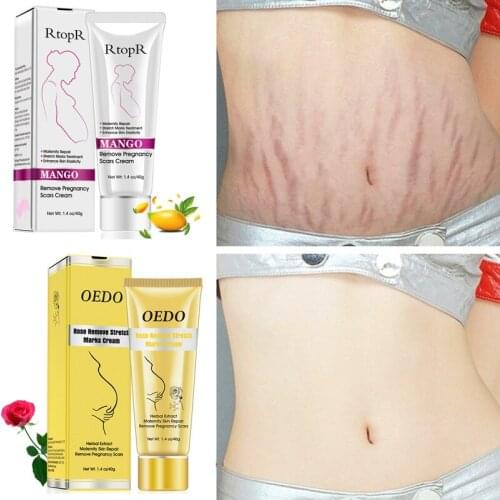 Hotsale Removes Stretch Mark Cream To Remove Postpartum Obesity Pregnant Women Repair Anti-Aging Anti-Winkles Firming Body Cream