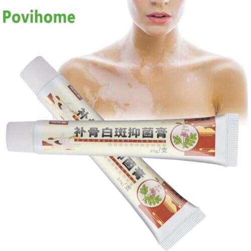 20g White Spot Ointment Vitiligo Cream Treatment Antibacterial Cream Localized Disease Mycosis Leukoplakia Plaster Skin Care