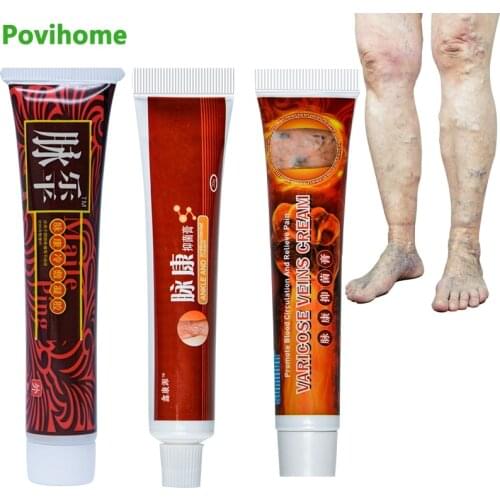 1pcs Varicose Veins Cream Of 3 Types Vasculitis Phlebitis legs Angiitis Inflammation Blood Vessel Phlebitis Spider Cream