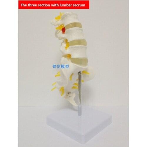 Free shipping&The lumbar vertebra model, Three lumbar vertebraes with sacrum model ,1:1 Natural Size,for medical teaching