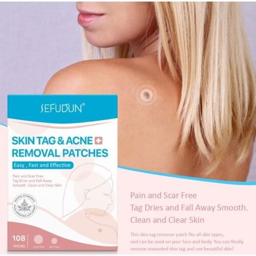 108 Patches Skin Tag Remover Patch Wart Removal Stickers Cover Conceals Tags Fast Easy Smooth
