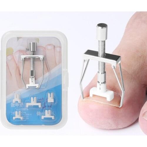 Ingrown Toe Nail Recover Correction Tool Pedicure Toenail Fixer Foot Nail Care Tool Orthotic Nail Corrector Pedicure Tool
