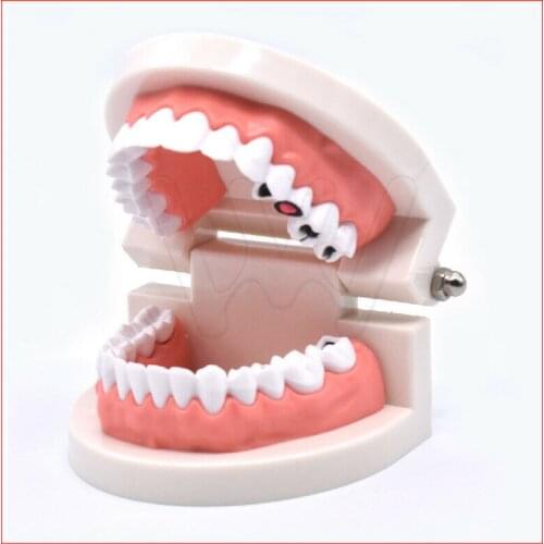 Dental Study Teaching Teeth Model Caries Tooth Care Education Dentist Equipment