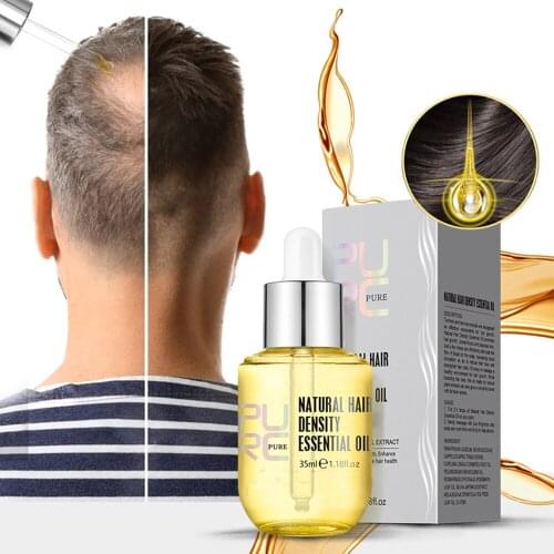 Tolaccea Hair Loss Remedies