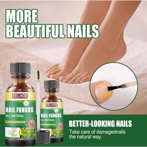 30ml Fungal Nail Repair Essence Serum Fast Absorption Mild Ingredients Feet Care Whitening Anti Infection Fungus Essence