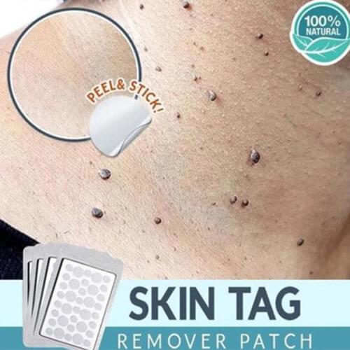 1-5 Sheets Wart Removal Stickers with 1pcs Wart Removal Pen Set Skin Tag Remover Patch Face Acne Pimple Hydrocolloid Master