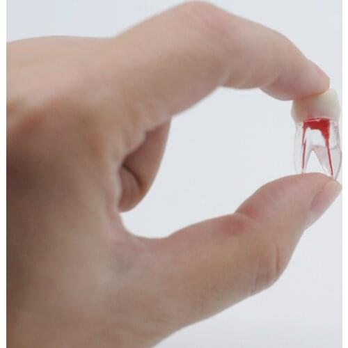 Dental Resin Endodontic Practice Operation Model Colored Root Canal & Pulp Model Dentist Tools For Student Study Practice